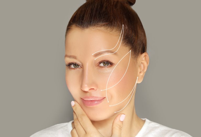 PDO Thread Lifts Explained: The Non-Surgical Facelift Revolution